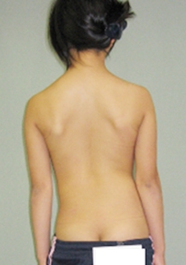 brac img1 1